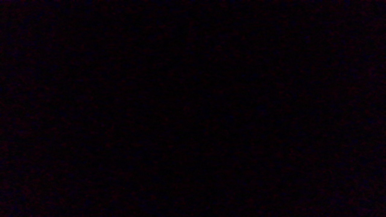 My camera light comes on, but no image appears. 3908b594-bba6-433d-8fcc-5febfa064e11?upload=true.jpg