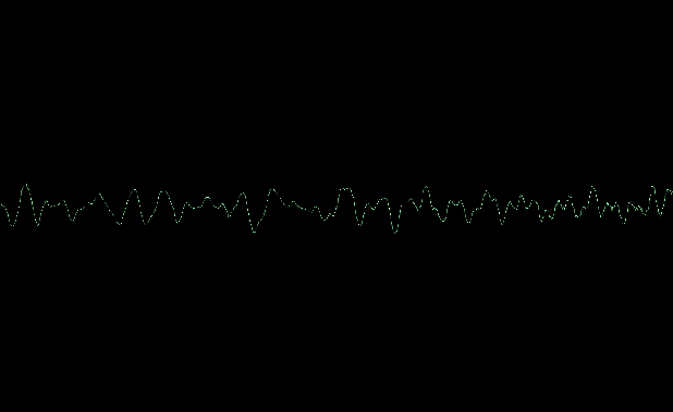 Windows Media Player: Audio Heartbeat line no image ad270e60-3277-448e-9a71-65fde86574f3?upload=true.png