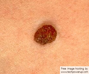 Possibility of Retrieving files inadvertently stored on my hard drive. mole.jpg